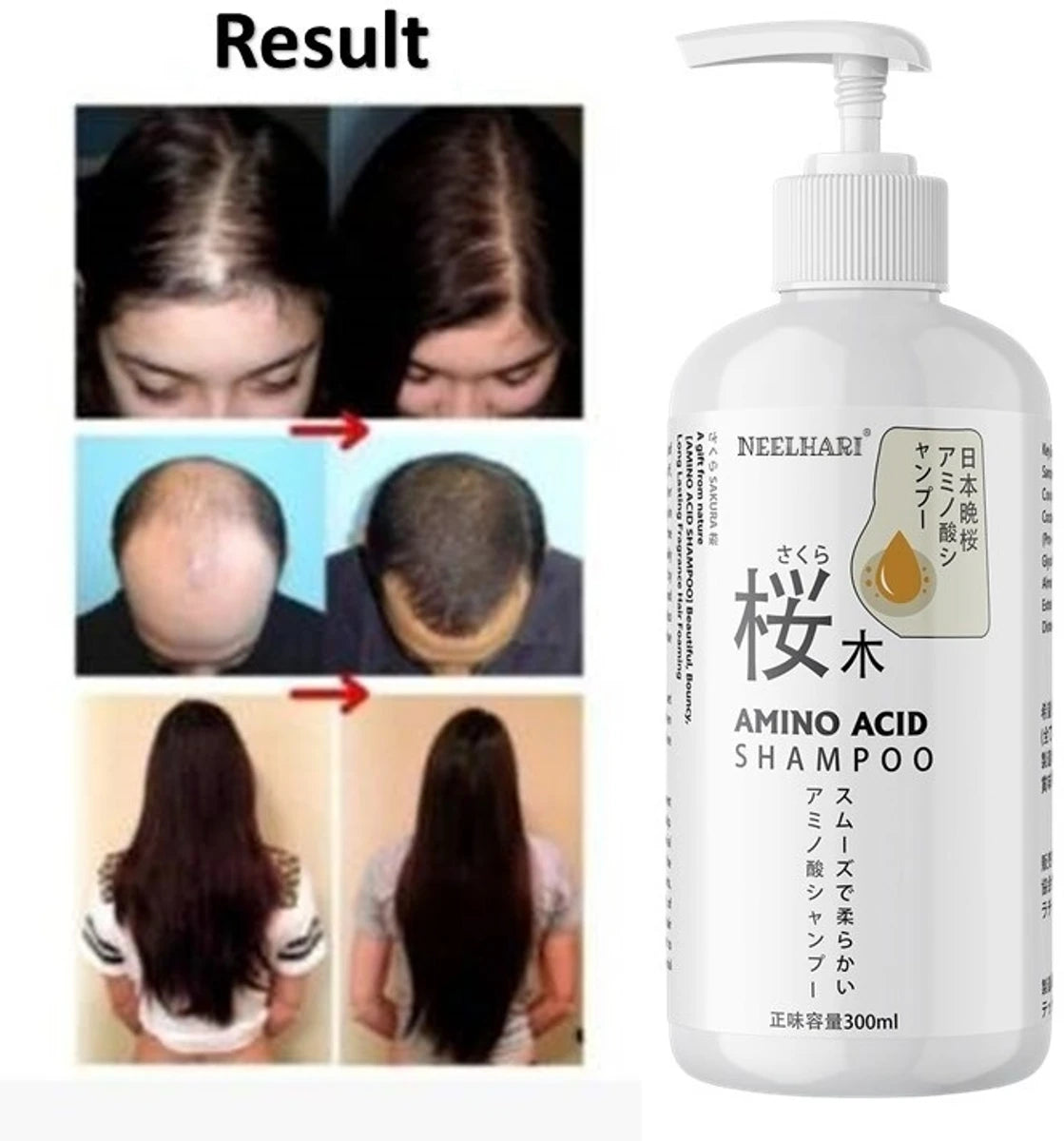 🌸 "Japan’s High-Quality Sakura Formula for Fuller, Healthier Hair" (Pack of 2)